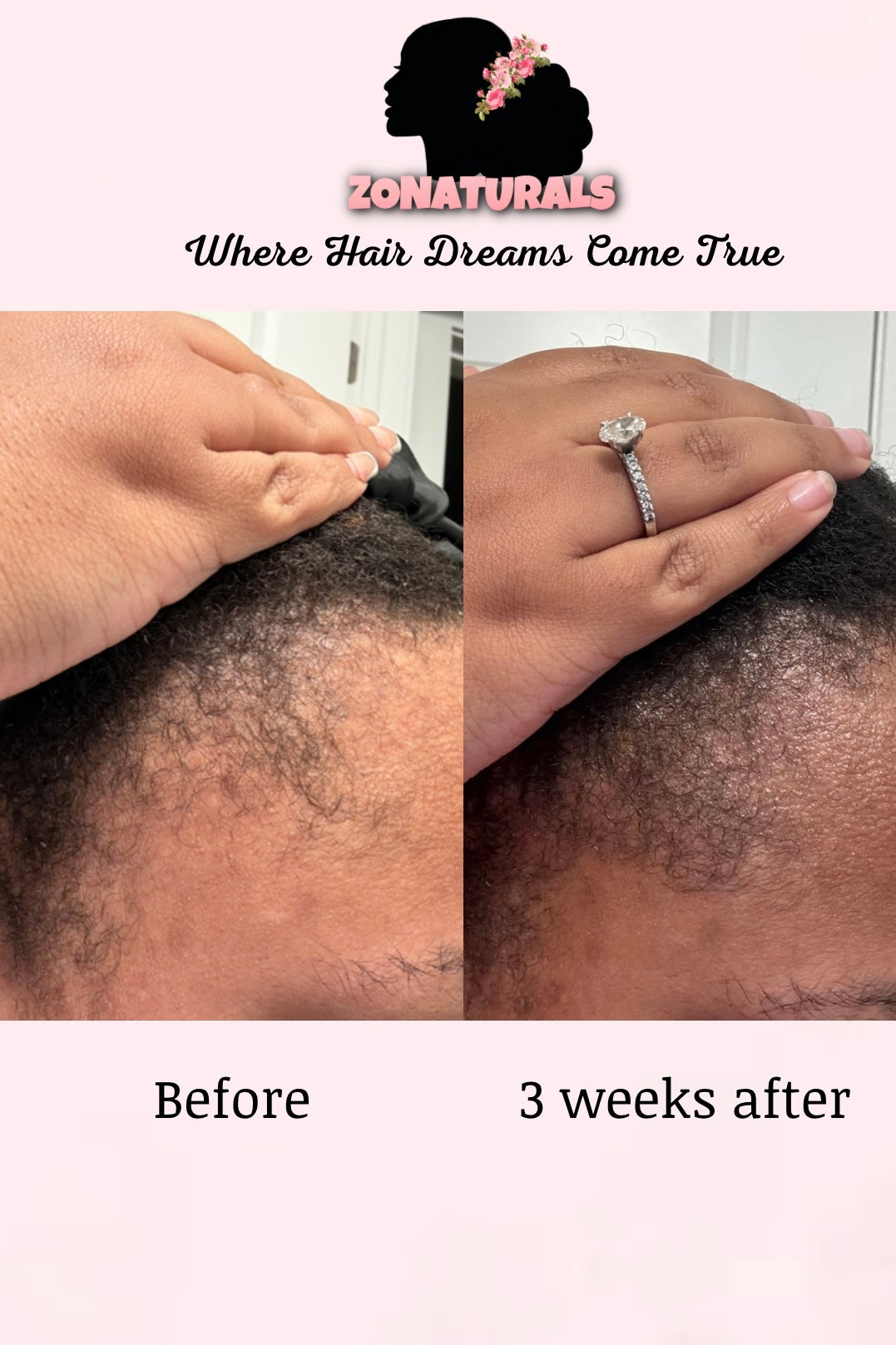 HIBISCUS HAIR GROWTH OIL 2OZ