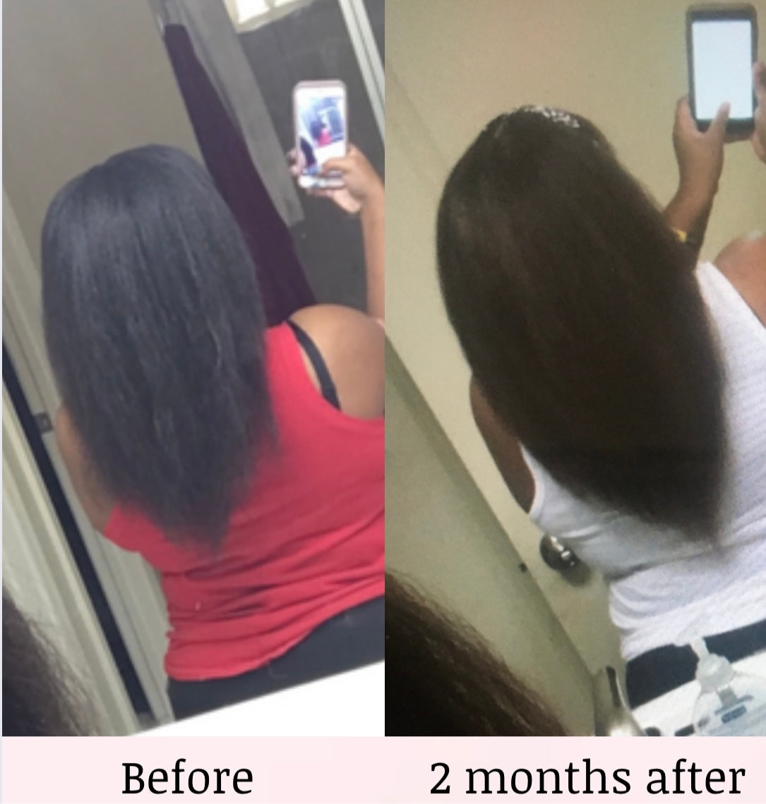 HAIR GROWTH BUNDLE with 4OZ OIL