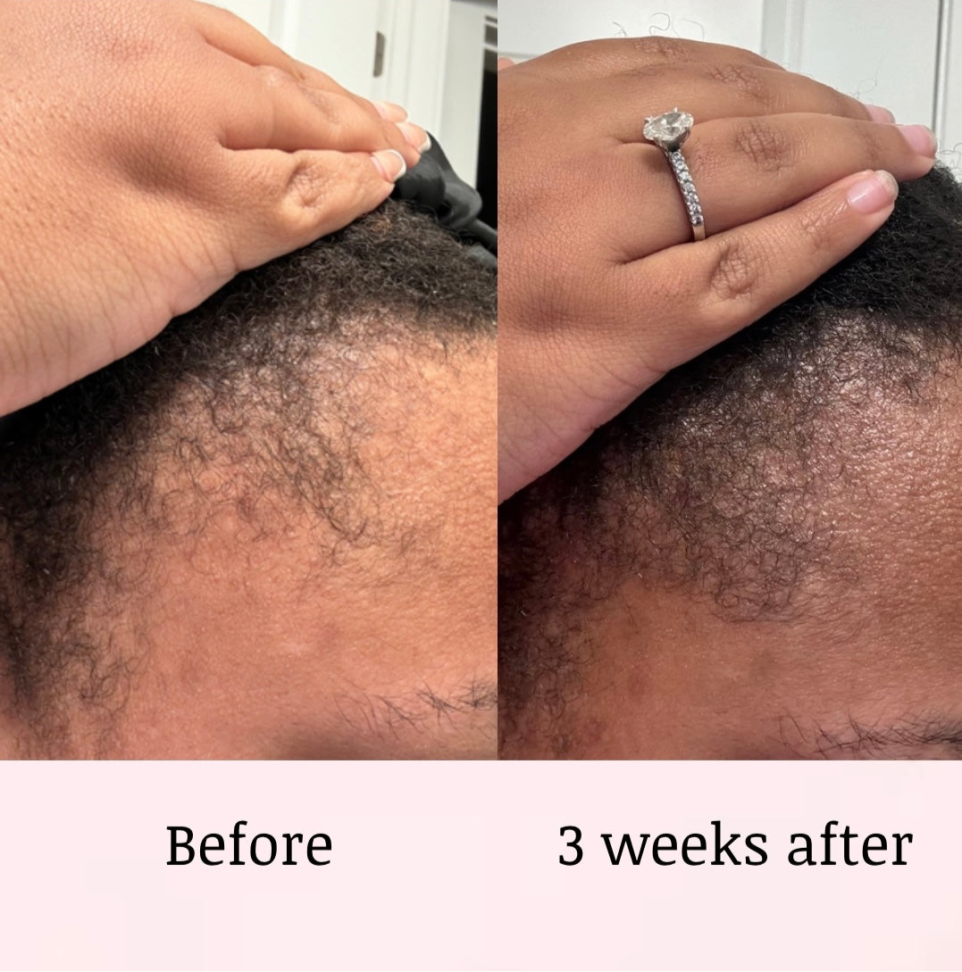 HAIR GROWTH BUNDLE with 4OZ OIL