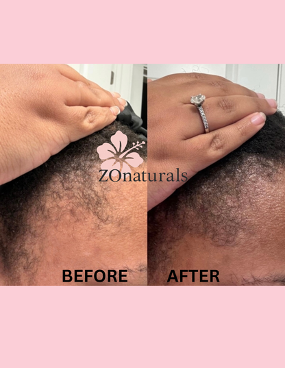 HIBISCUS HAIR GROWTH BUNDLE w/ 4OZ OIL
