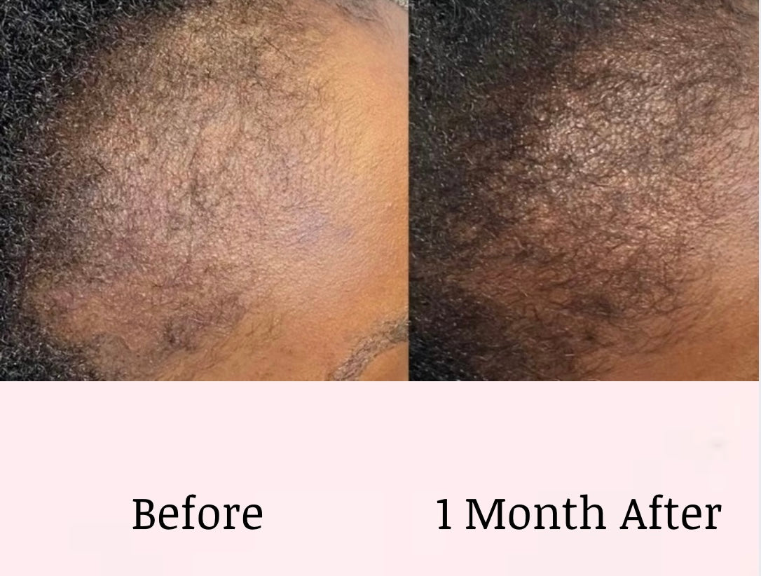 HIBISCUS INFUSED HAIR GROWTH OIL 4OZ