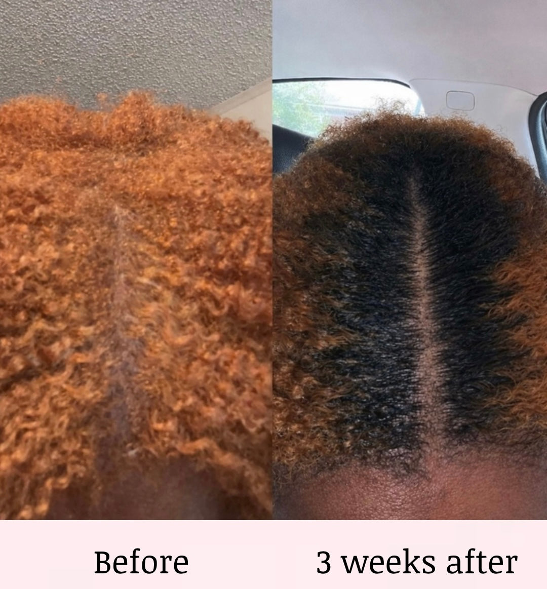 HIBISCUS INFUSED HAIR GROWTH OIL 4OZ